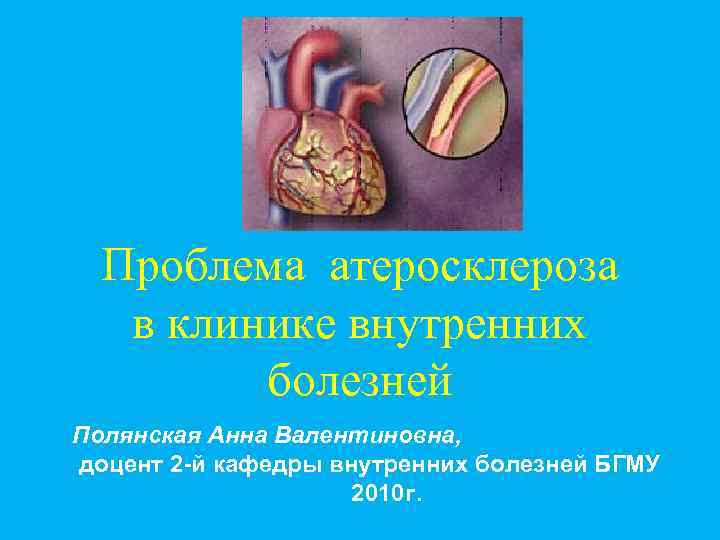 Проблема атеросклероза в клинике внутренних болезней Полянская Анна Валентиновна, доцент 2 -й кафедры внутренних