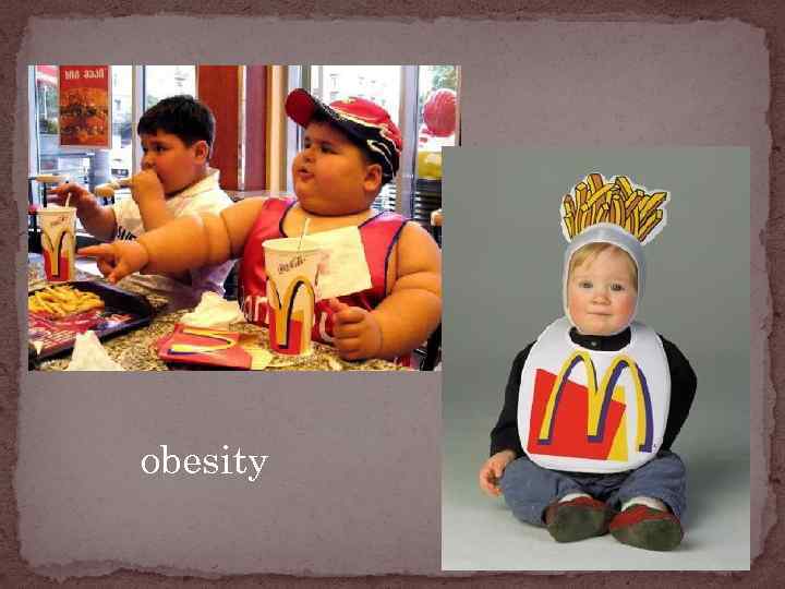 obesity 