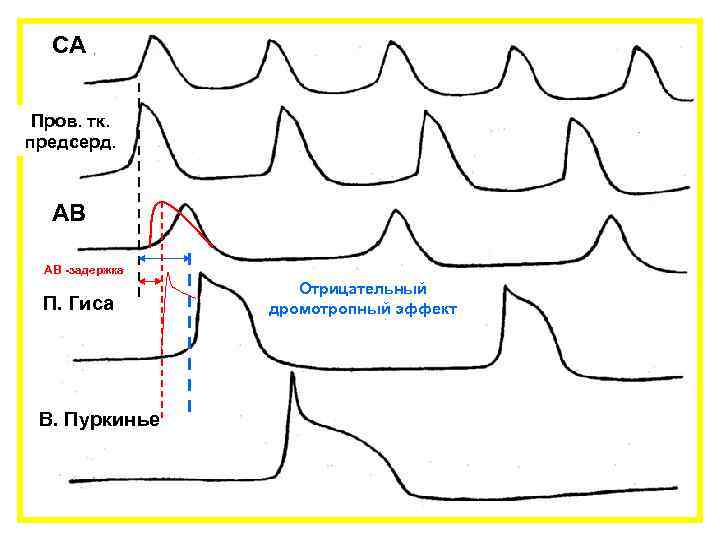 СА Пров. тк. предсерд. АВ АВ -задержка П. Гиса В. Пуркинье Отрицательный дромотропный эффект