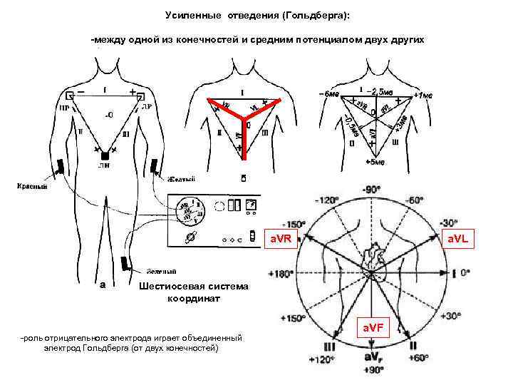 12 отведений экг схема