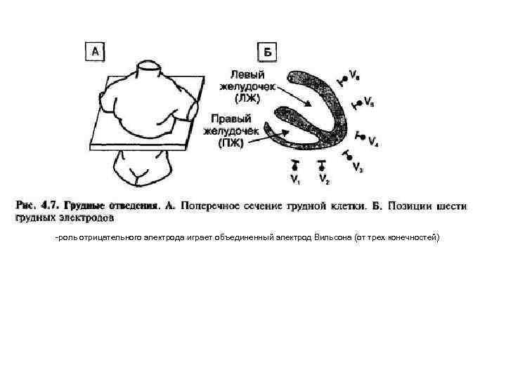 -роль отрицательного электрода играет объединенный электрод Вильсона (от трех конечностей) 