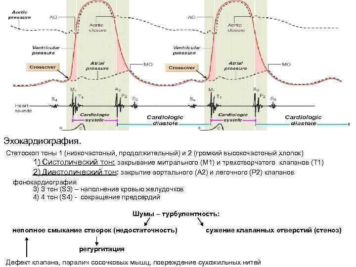 Эхокардиография. Стетоскоп тоны 1 (низкочастоный, продолжительный) и 2 (громкий высокочастоный хлопок) 1) Систолический тон: