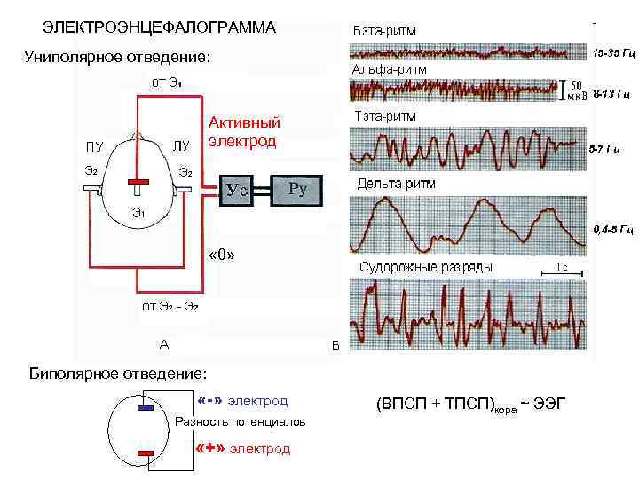 ЭЛЕКТРОЭНЦЕФАЛОГРАММА 15 -35 Гц Униполярное отведение: 8 -13 Гц Активный электрод 5 -7 Гц