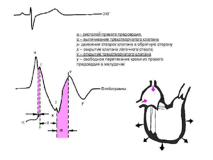 а - систолой правого предсердия. с – выпячивание трехстворчатого клапана x- движение створок клапана