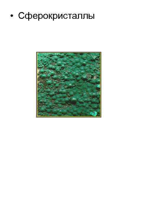  • Сферокристаллы 