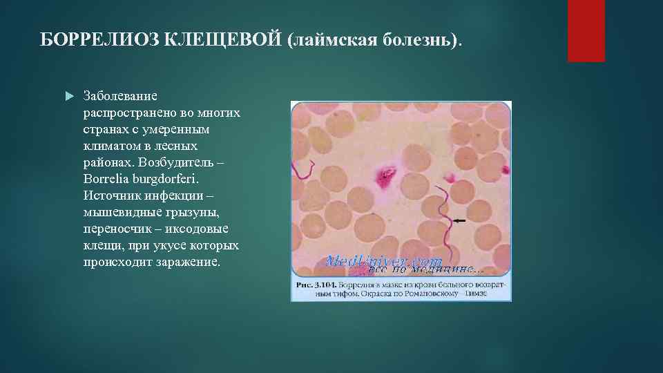 БОРРЕЛИОЗ КЛЕЩЕВОЙ (лаймская болезнь). Заболевание распространено во многих странах с умеренным климатом в лесных