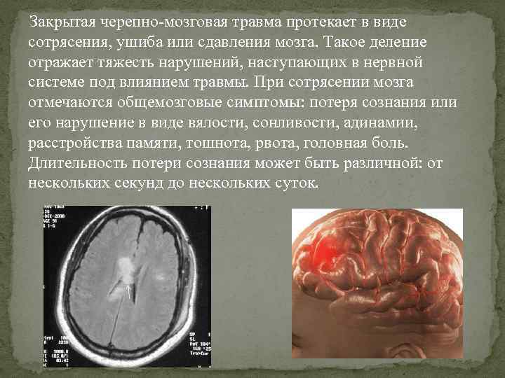 Закрытая черепно-мозговая травма протекает в виде сотрясения, ушиба или сдавления мозга. Такое деление отражает