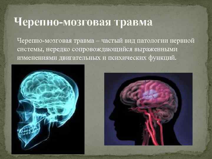 Черепно-мозговая травма – частый вид патологии нервной системы, нередко сопровождающийся выраженными изменениями двигательных и