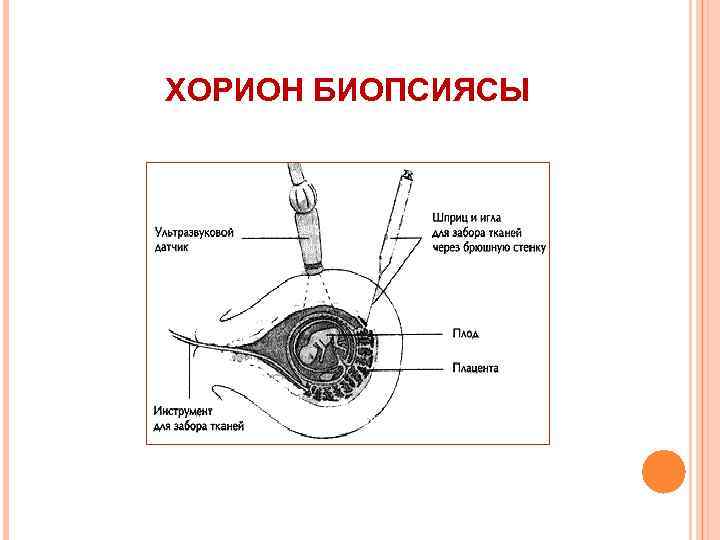 ХОРИОН БИОПСИЯСЫ 