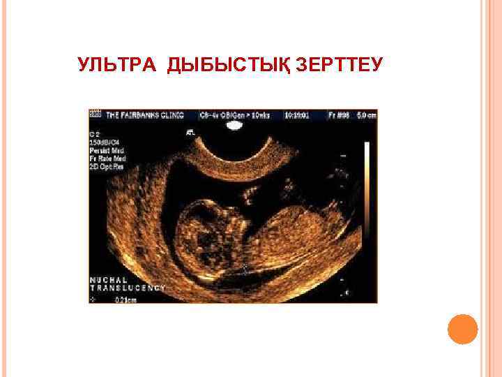 УЛЬТРА ДЫБЫСТЫҚ ЗЕРТТЕУ 