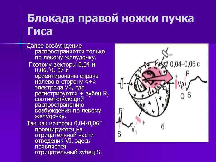 Замедление проводимости пучка гиса