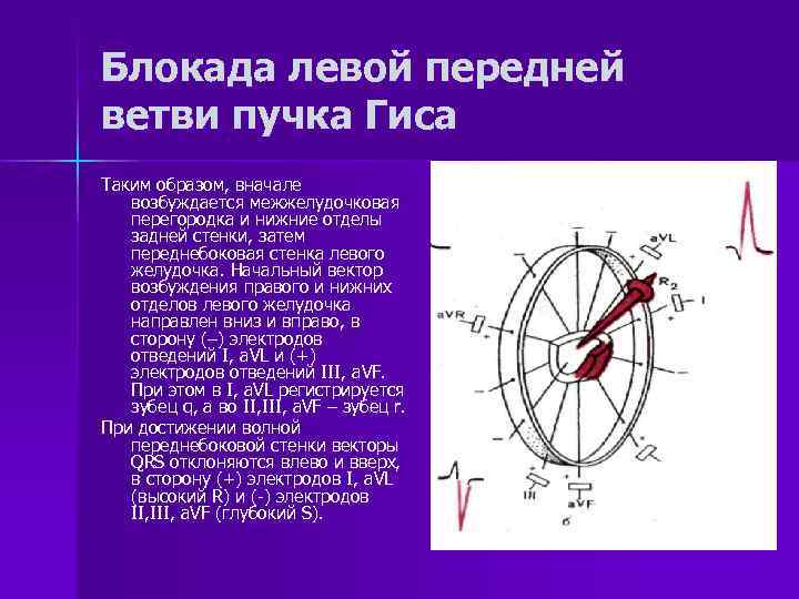 Блокада левой передней ветви пучка Гиса Таким образом, вначале возбуждается межжелудочковая перегородка и нижние