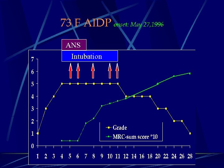 73 F AIDP onset: May 27, 1996 ANS Intubation 