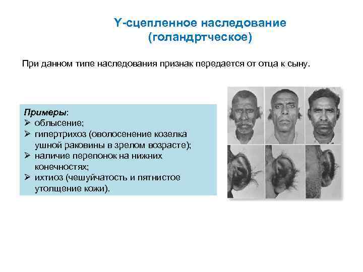 Y сцепленное наследование (голандртческое) При данном типе наследования признак передается от отца к сыну.