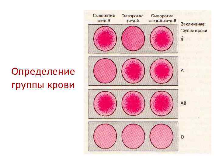 Определение группы крови 