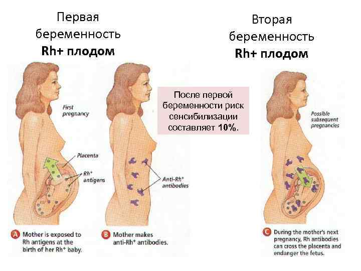 Первая беременность Rh+ плодом Вторая беременность Rh+ плодом После первой беременности риск сенсибилизации составляет