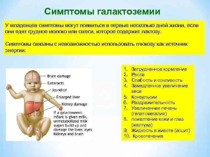 Галактоземия признаки заболевания. Галактоземия клинические симптомы. Диагностические критерии галактоземии. Галактоземия диагностические признаки. Галактоземия у детей клинические рекомендации.