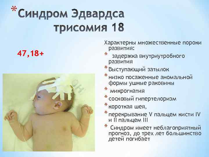 * 47, 18+ Характерны множественные пороки развития: * задержка внутриутробного развития * Выступающий затылок