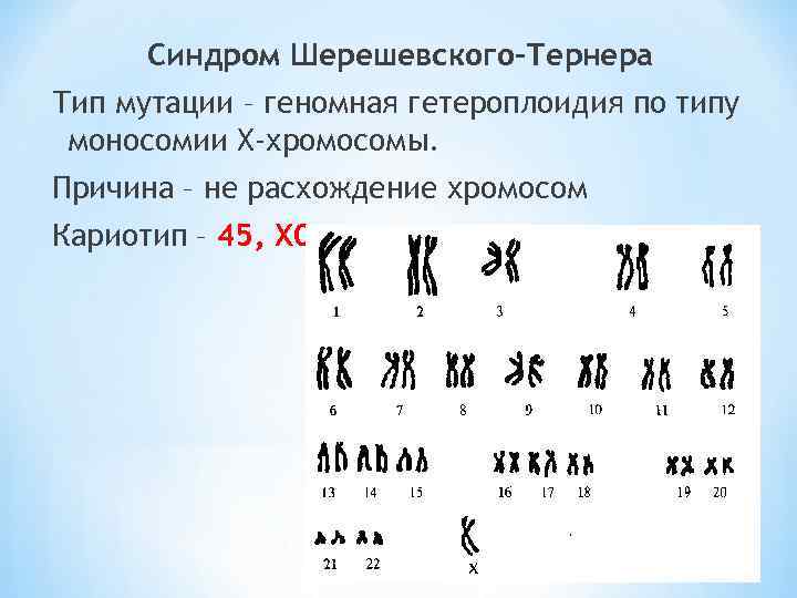 Кариотип 45. Синдром Шерешевского Тернера кариотип. Синдром Шерешевского Тернера кариотип 45х. Кариотип больного синдрома Тернера. Кариотип при Шерешевском Тернере.