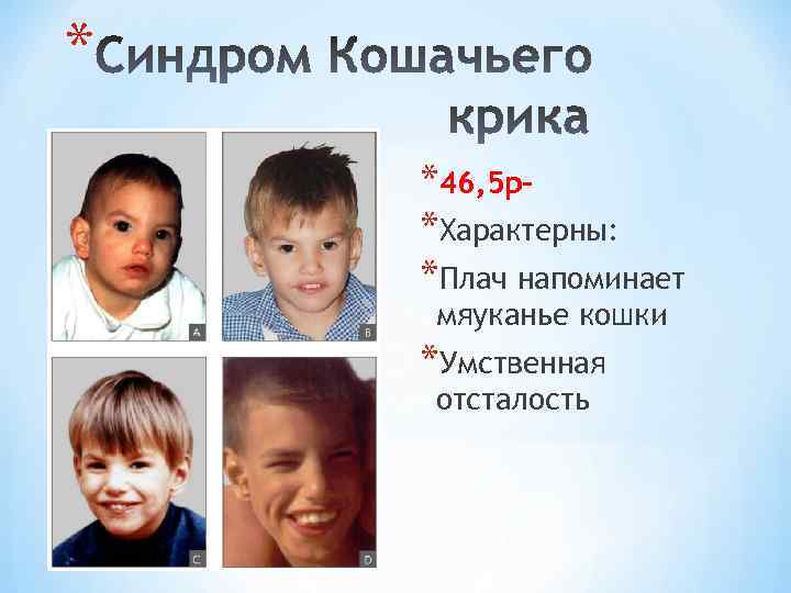 * *46, 5 р*Характерны: *Плач напоминает мяуканье кошки *Умственная отсталость 