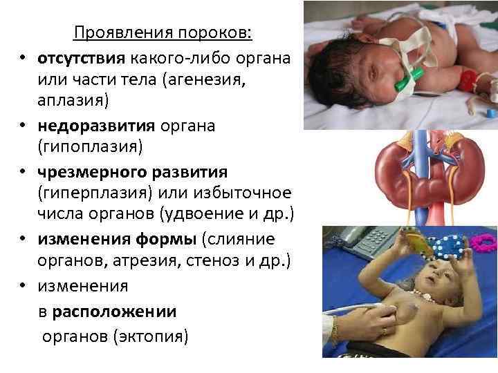 Постэмбриональное развитие схема