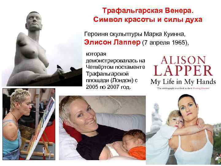 Трафальгарская Венера. Символ красоты и силы духа Героиня скульптуры Марка Куинна, Элисон Лаппер (7