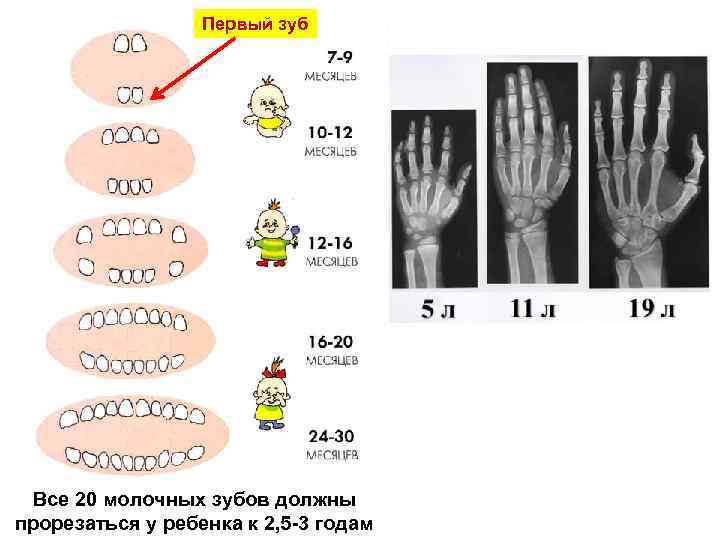 Первый зуб Все 20 молочных зубов должны прорезаться у ребенка к 2, 5 -3
