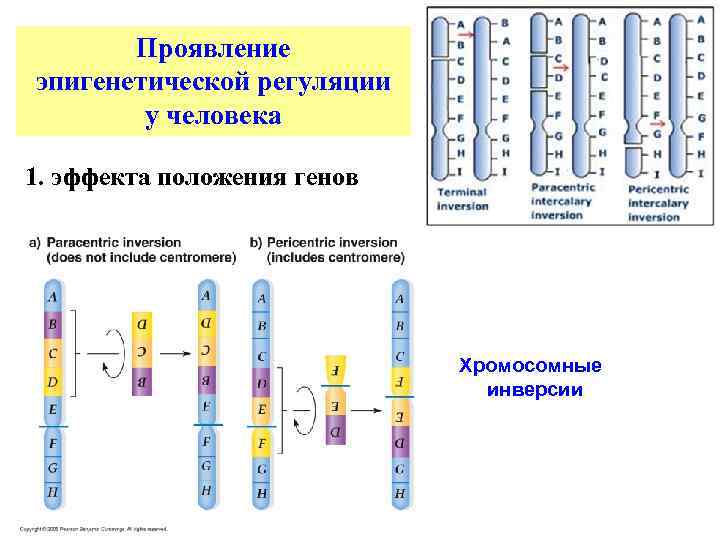 Проявление эпигенетической регуляции у человека 1. эффекта положения генов Хромосомные инверсии 