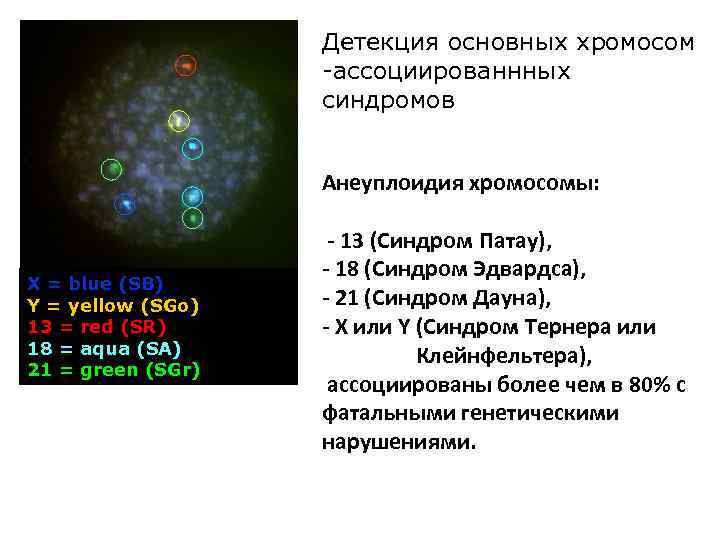 Детекция основных хромосом -ассоциированнных синдромов Анеуплоидия хромосомы: X = blue (SB) Y = yellow