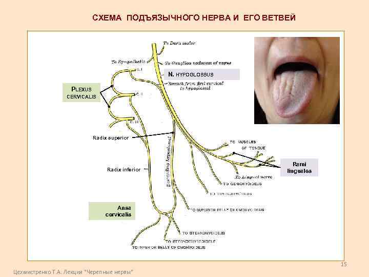 СХЕМА ПОДЪЯЗЫЧНОГО НЕРВА И ЕГО ВЕТВЕЙ N. HYPOGLOSSUS PLEXUS CERVICALIS Radix superior Radix inferior