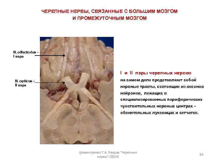 ЧЕРЕПНЫЕ НЕРВЫ, СВЯЗАННЫЕ С БОЛЬШИМ МОЗГОМ И ПРОМЕЖУТОЧНЫМ МОЗГОМ N. olfactorius I пара I