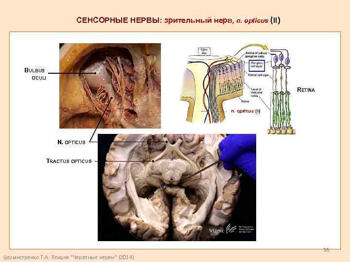 СЕНСОРНЫЕ НЕРВЫ: зрительный нерв, n. opticus (II) BULBUS OCULI RETINA n. opticus (II) N.