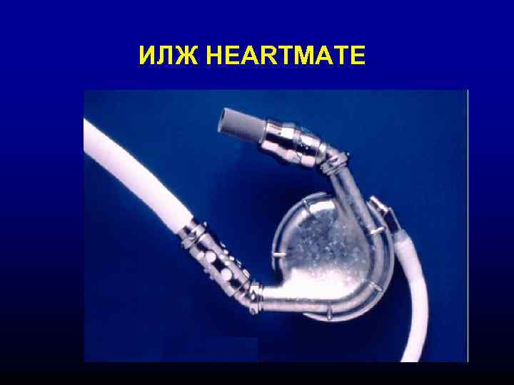 ИЛЖ HEARTMATE 