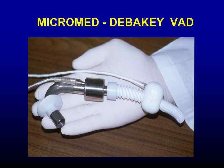 MICROMED - DEBAKEY VAD 