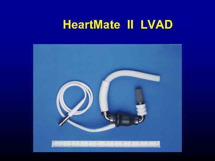 Heart. Mate II LVAD 
