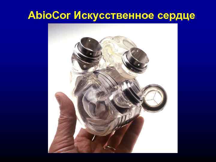 Abio. Cor Искусственное сердце 