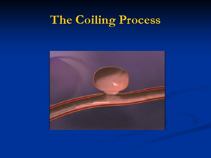 The Coiling Process 