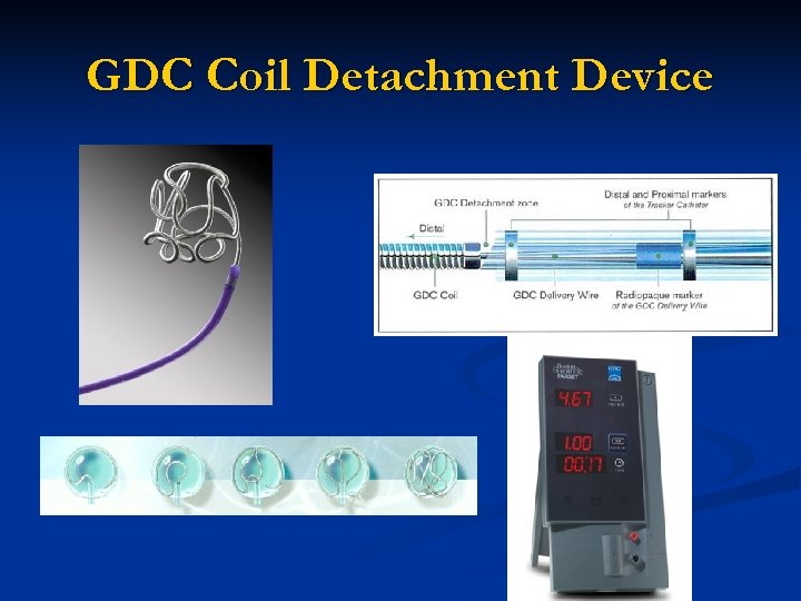 GDC Coil Detachment Device 