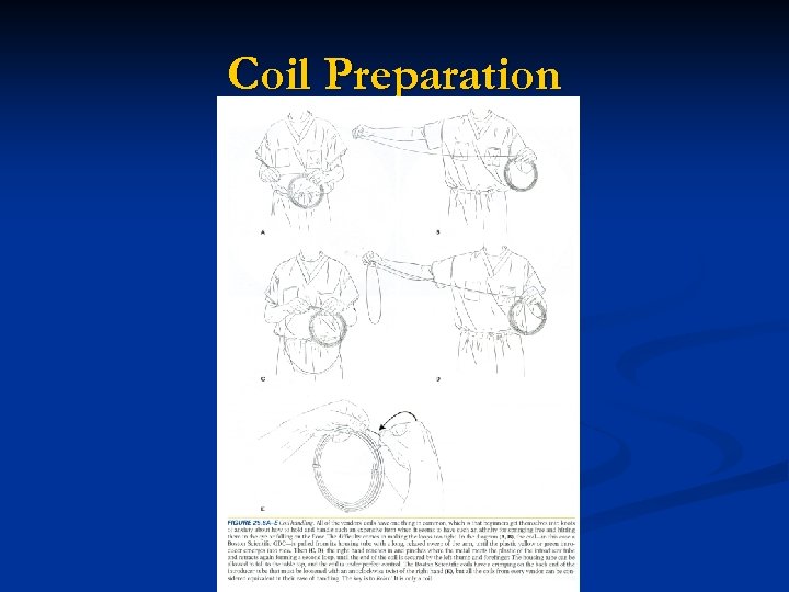 Coil Preparation 