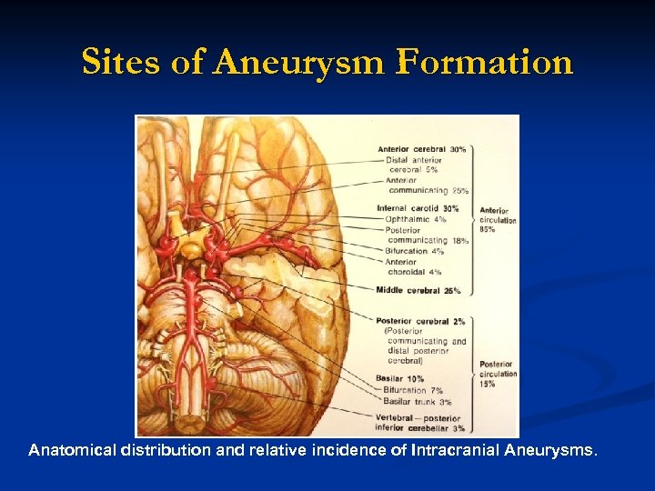 Sites of Aneurysm Formation Anatomical distribution and relative incidence of Intracranial Aneurysms. 