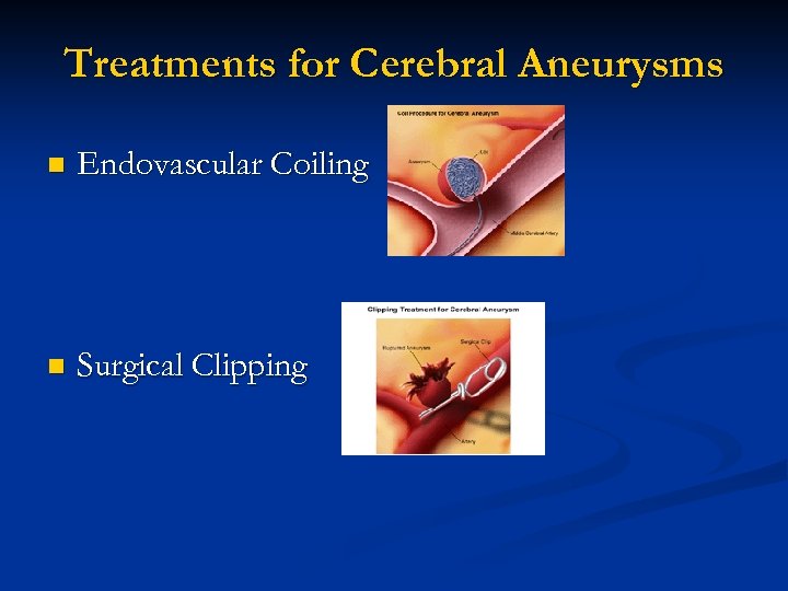 Treatments for Cerebral Aneurysms n Endovascular Coiling n Surgical Clipping 