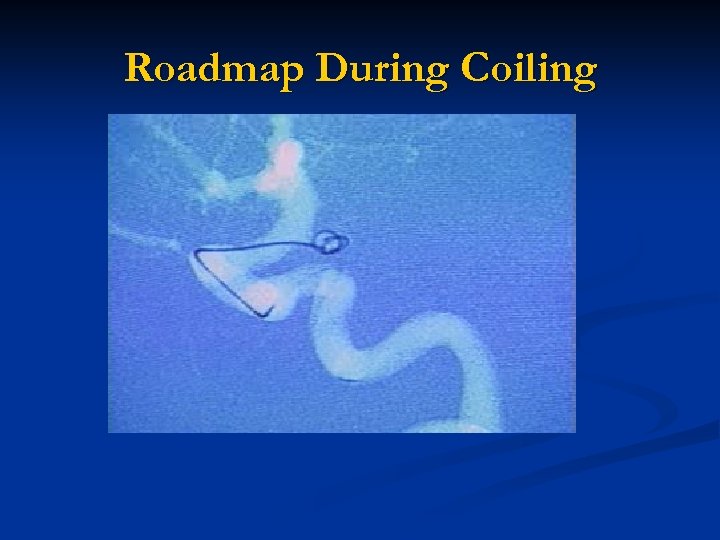 Roadmap During Coiling 