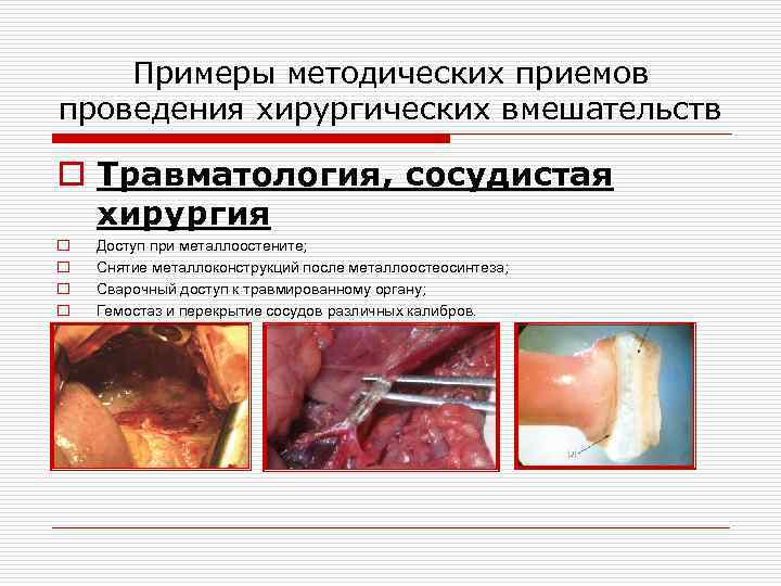 Примеры методических приемов проведения хирургических вмешательств o Травматология, сосудистая хирургия o o Доступ при