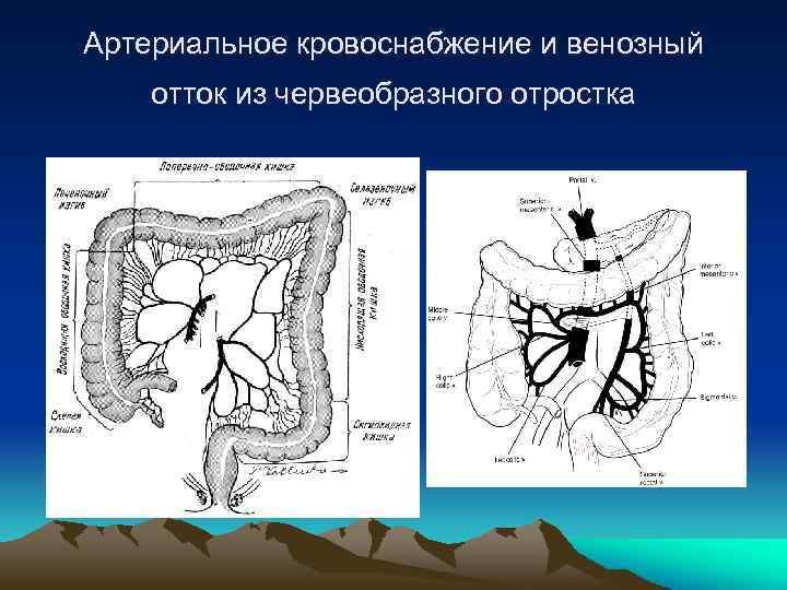 Сестринская карта острый аппендицит