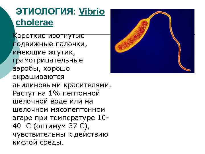 ЭТИОЛОГИЯ: Vibrio cholerae Короткие изогнутые подвижные палочки, имеющие жгутик, грамотрицательные аэробы, хорошо окрашиваются анилиновыми