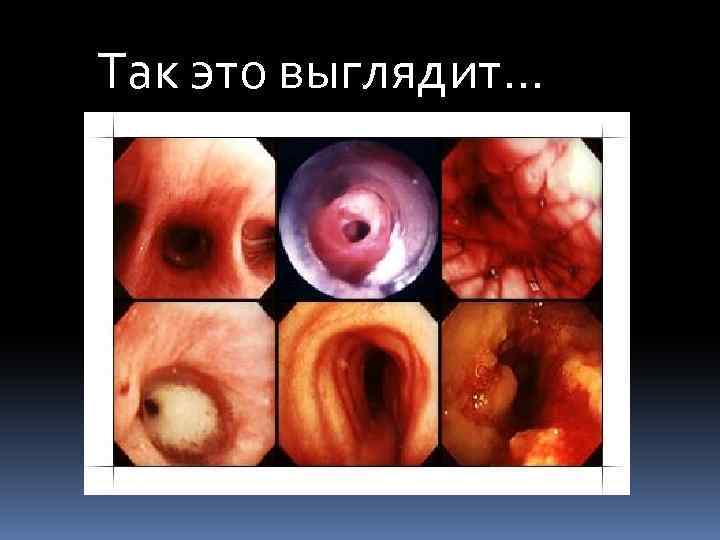 Так это выглядит… 