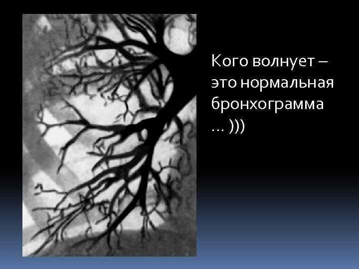 Кого волнует – это нормальная бронхограмма … ))) 