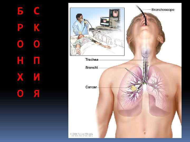 Б Р О Н Х О С К О П И Я 