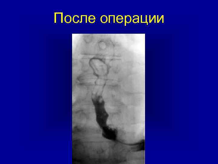 После операции 