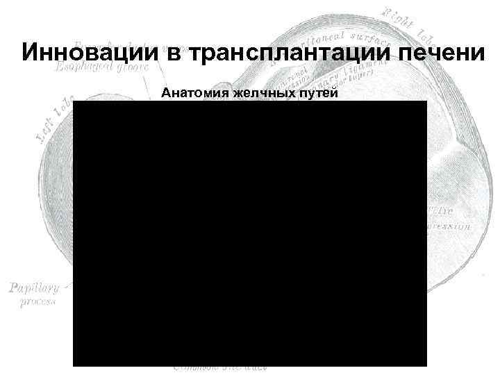  Инновации в трансплантации печени Анатомия желчных путей 